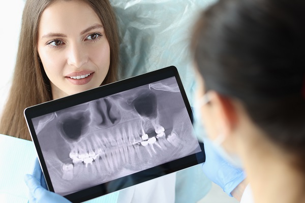 How Does A Dentist Know When A Bone Graft Is Necessary?
