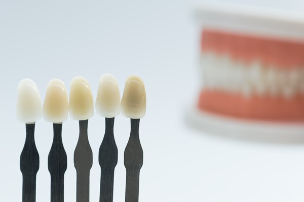 Dental Bonding: An Effective Way To Improve Your Smile