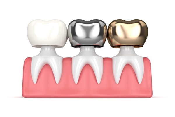 Tips For Taking Care Of Your Dental Crowns