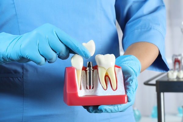 When A Bone Graft For Dental Implant Restoration May Be Recommended