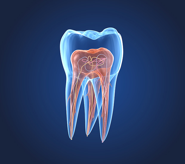 Johns Creek What is an Endodontist